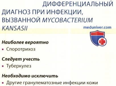   Mycobacterium kansasii