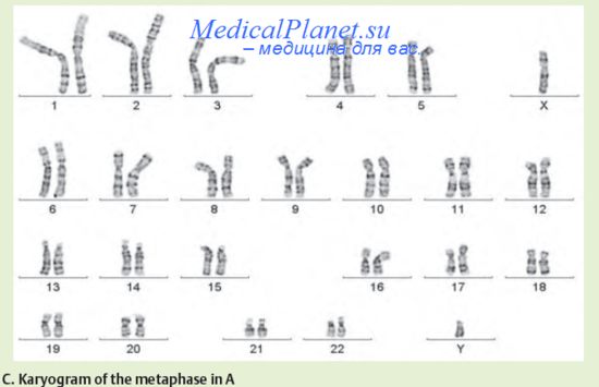 http://medicalplanet.su/genetica/Img/193.jpg