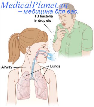 детский туберкулез