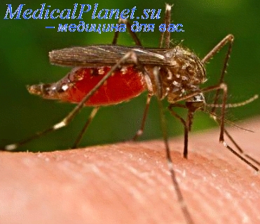 тяжелая малярия
