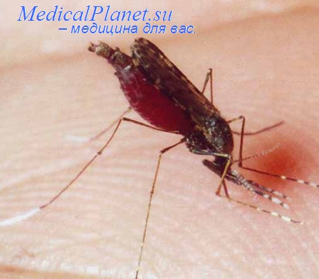 малярия у детей