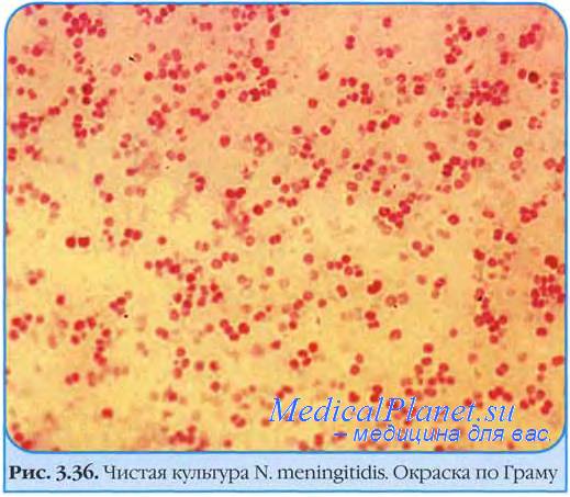 Структура менингококковой инфекции. Факторы риска менингококковой инфекции