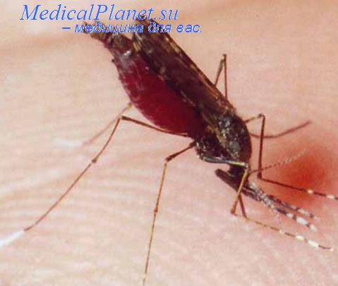 эпидемия малярии