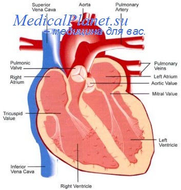 гипертрофия сердца