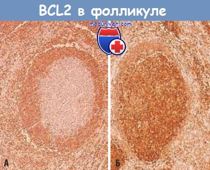 BCL2 в фолликуле