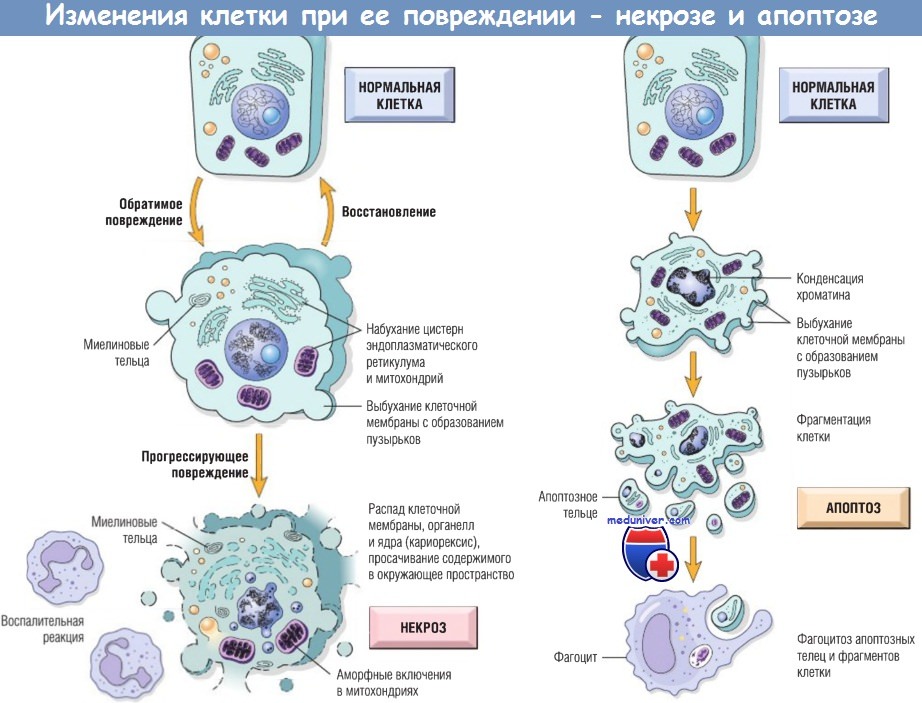 Поражения клеток. Схема гибели клеток при некрозе и апоптозе. Морфологические изменения клеток при апоптозе. Схема изменений в клетке при некрозе. Апоптоз и некроз изменения в ядре.