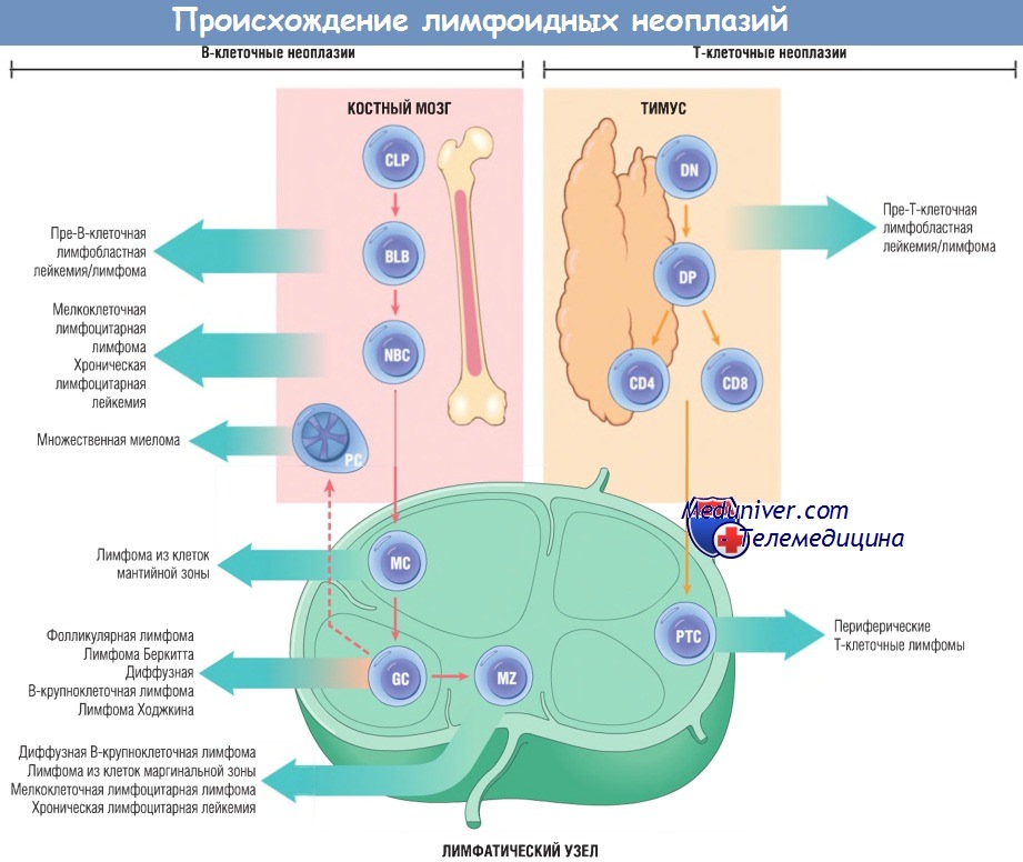 Происхождение лимфоидных неоплазий