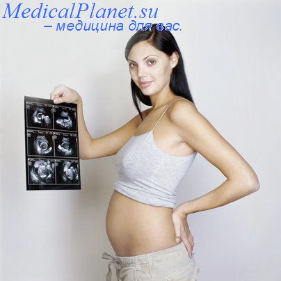 беременность и недоношенный ребенок