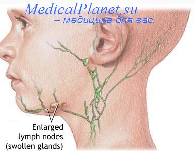 лимфатические узлы