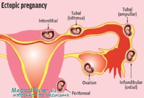 эндометрий и эмбрион