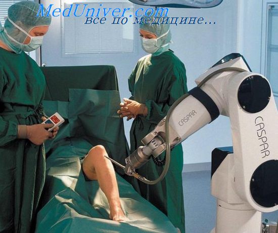 роботы в хирургии