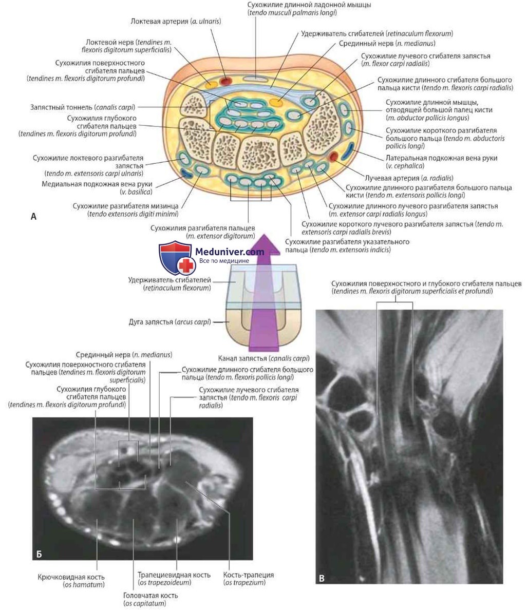 Канал запястья и структуры запястья: анатомия, топография