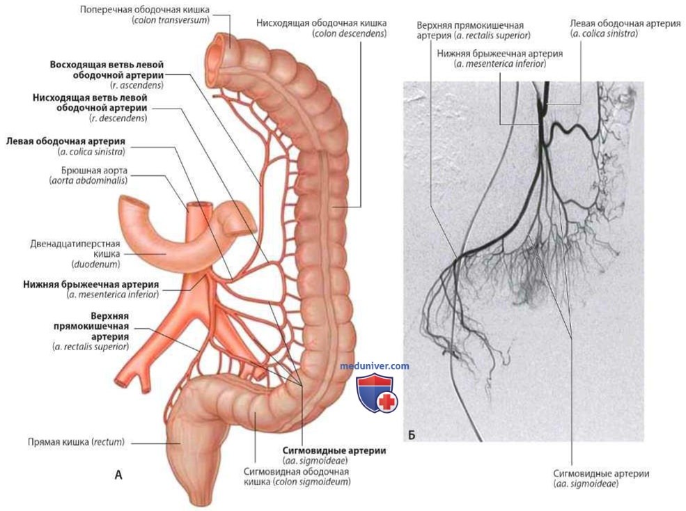 Нижняя брыжеечная артерия (a. mesenterica inferior): анатомия, топография