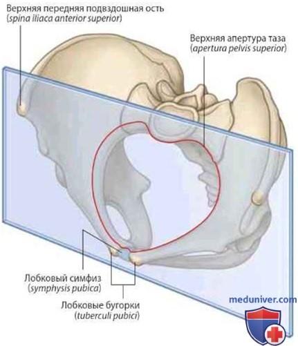 Положение таза в норме: анатомия, топография