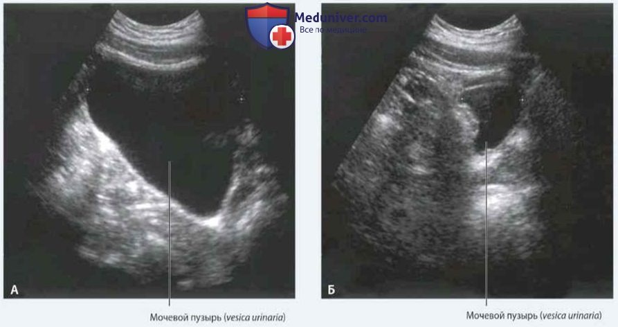 Мочеиспускательный канал (urethra) мужской и женский: анатомия, топография