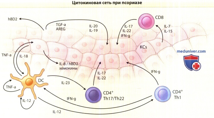 Цитокиновая сеть при псориазе
