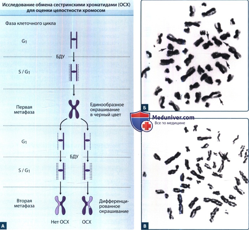 Образование двухроматидных хромосом спирализация хромосом. Дочерние хромосомы и сестринские хроматиды. Хромосома до и после репликации. Вид сестринской хромосомы. Сестринские хроматиды.