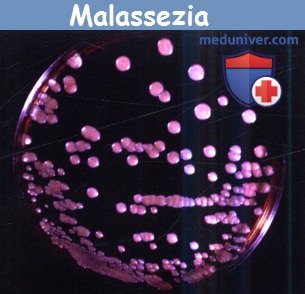 Malassezia