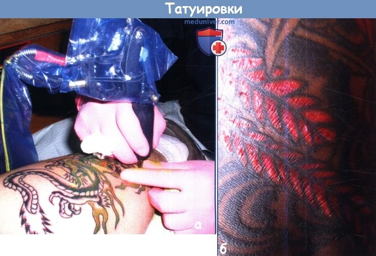 Татуировки
