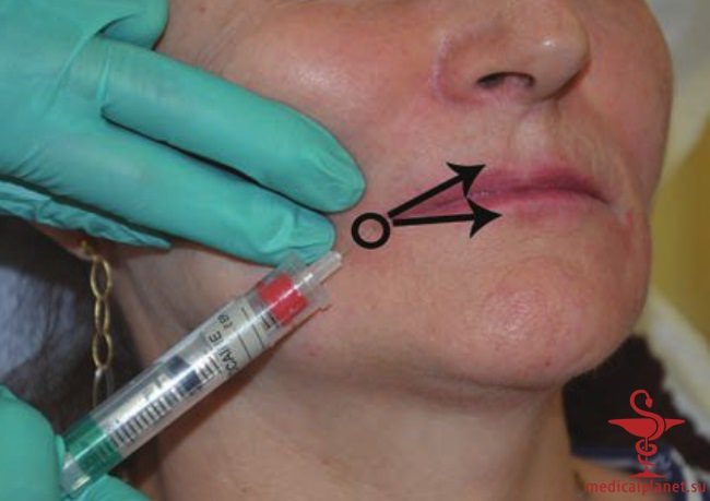 ������� �������� �������� (������������ �����������) � ������������ � �� ����������