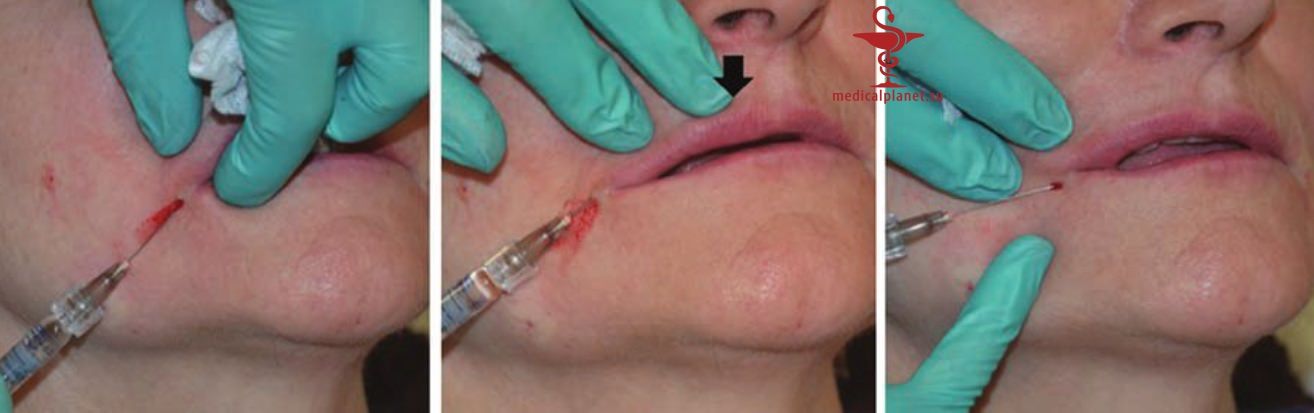 ������� �������� �������� (������������ �����������) � ������������ � �� ����������