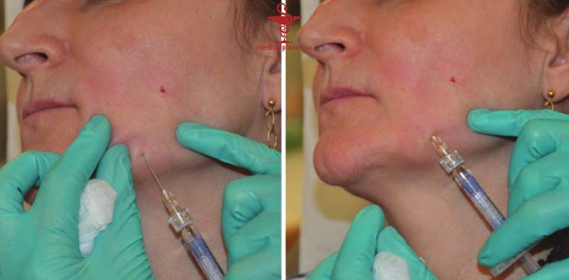 ������� �������� �������� (������������ �����������) � ������������ � �� ����������