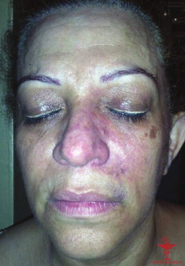 ������� �������� �������� (������������ �����������) � ������������ � �� ����������