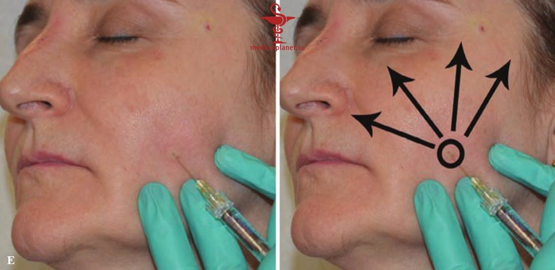 ������� �������� �������� (������������ �����������) � ������������ � �� ����������