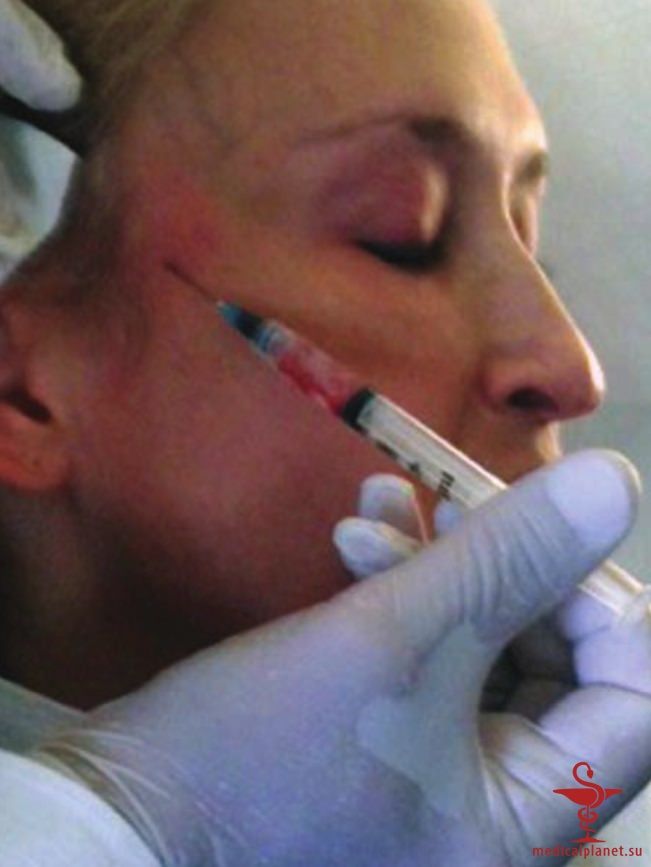 ������� �������� �������� (������������ �����������) � ������������ � �� ����������