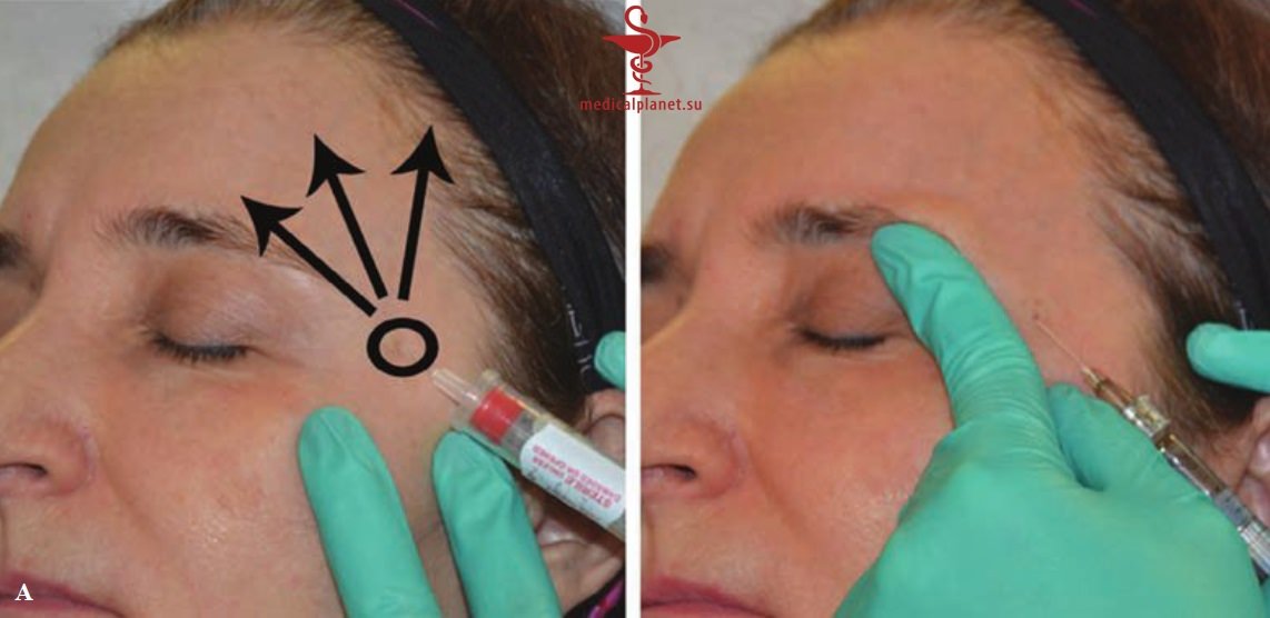 ������� �������� �������� (������������ �����������) � ������������ � �� ����������