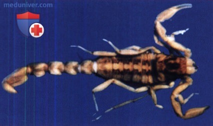 Укус скорпиона Centruroides.
