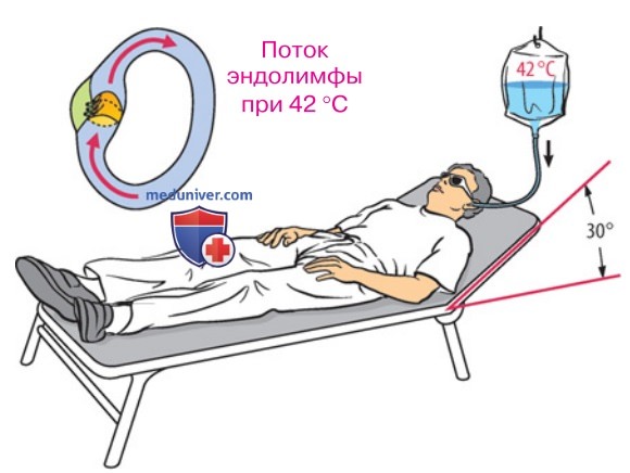 Центральная вестибулярная система
