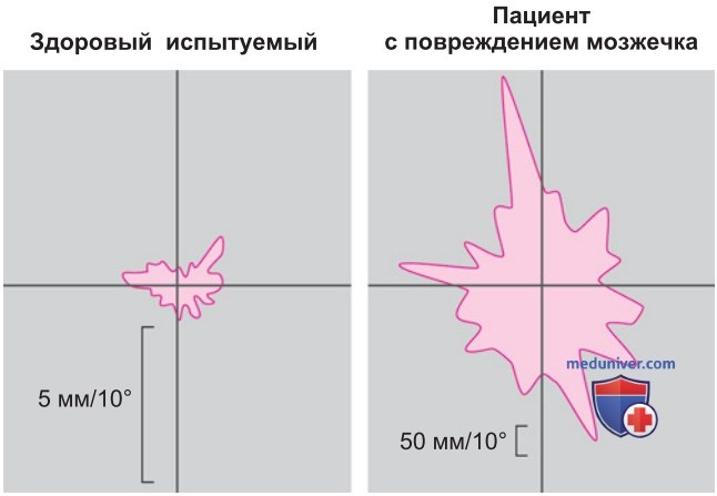 Оптимизация поддержания позы и целенаправленных движений мозжечком
