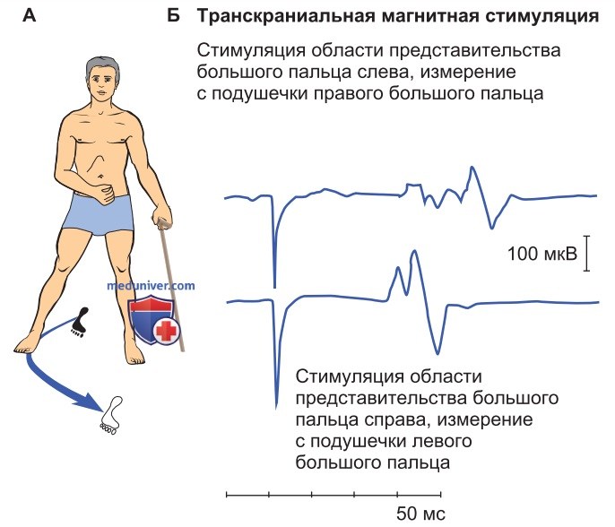 Функциональная организация моторных областей коры головного мозга