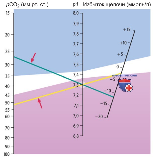 Нарушения кислотно-основного баланса