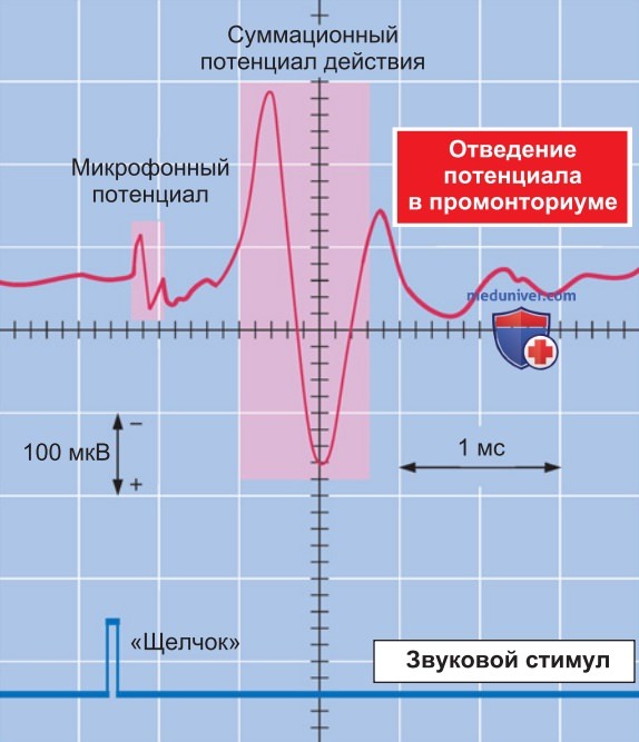 Трансформация сигнала от чувствительной клетки уха к слуховому нерву