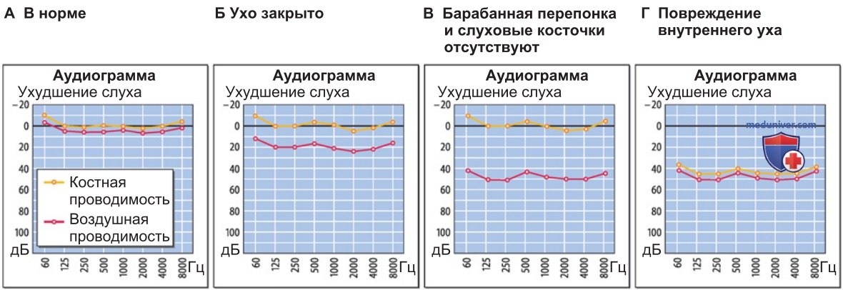 Ухо и звук