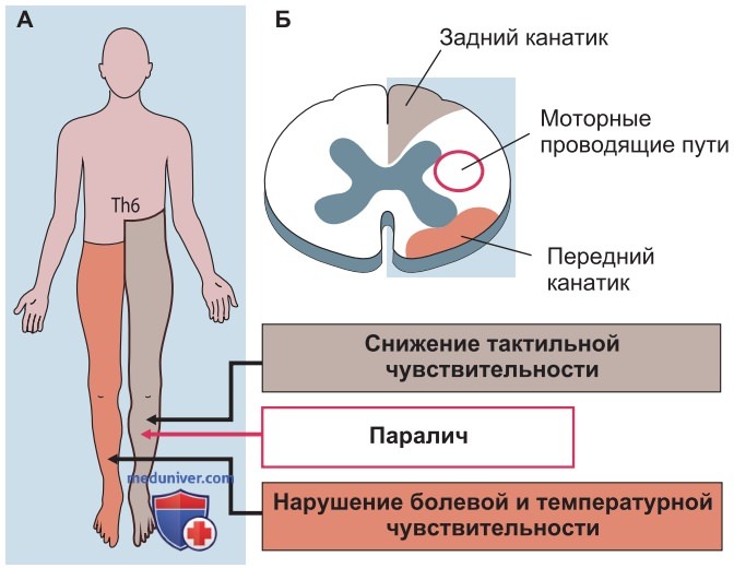 Соматосенсорные проводящие пути и субмодальности