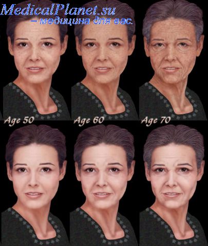 факторы старения