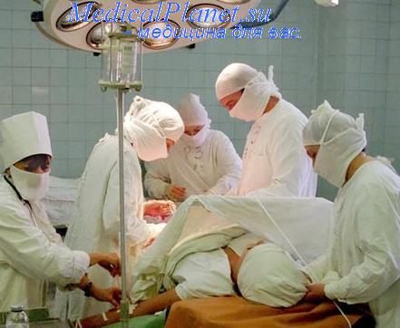 операция в гинекологии