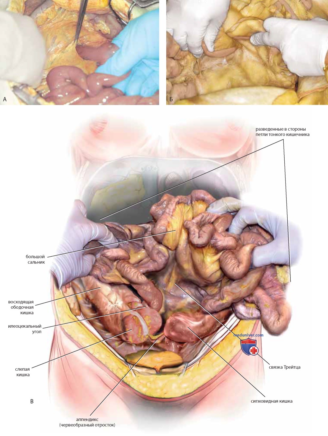 Хирургическая анатомия тонкого и толстого кишечника