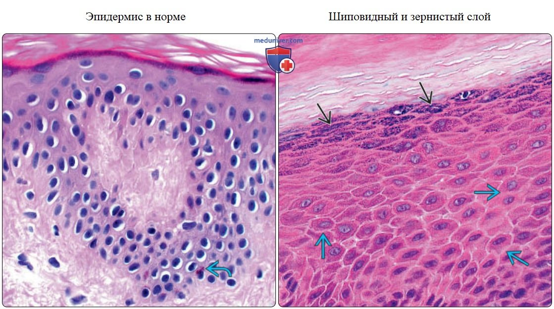 Эпидермис с кератиноцитами и меланоцитами - нормальная гистология под микроскопом