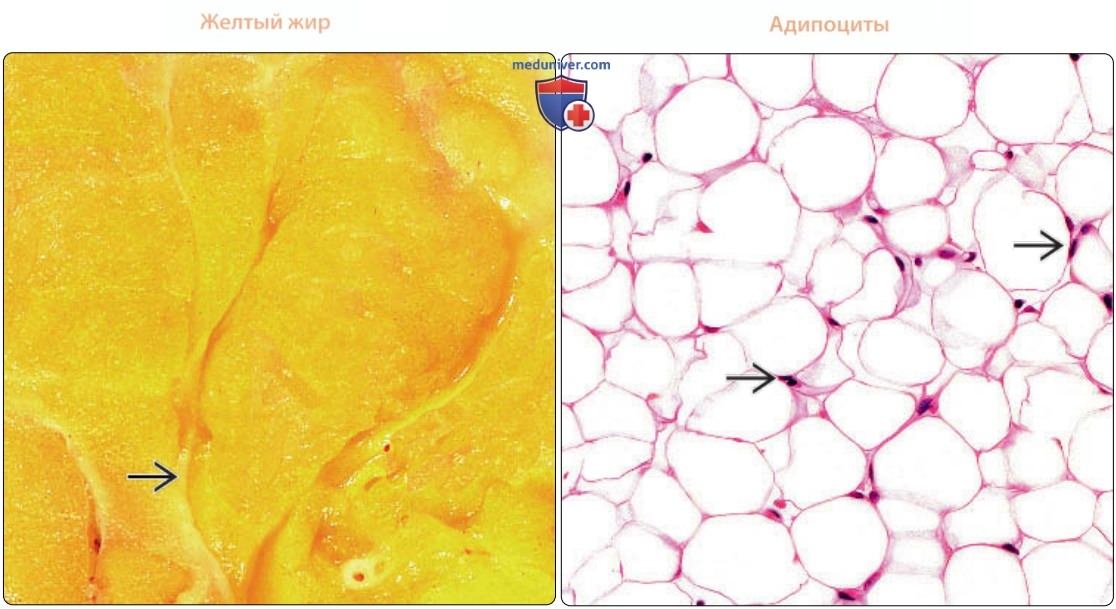 Жировая ткань - нормальная гистология под микроскопом