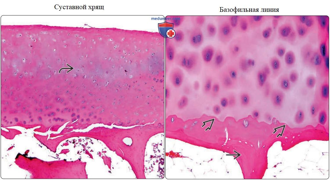 Кость и хрящ - нормальная гистология под микроскопом