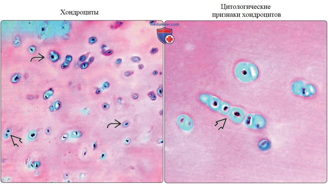 Кость и хрящ - нормальная гистология под микроскопом