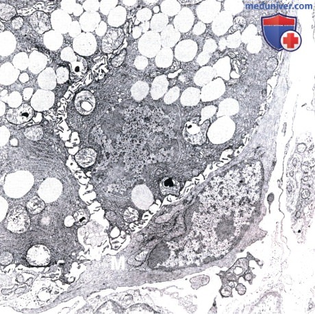 миоэпителиальные клетки желез