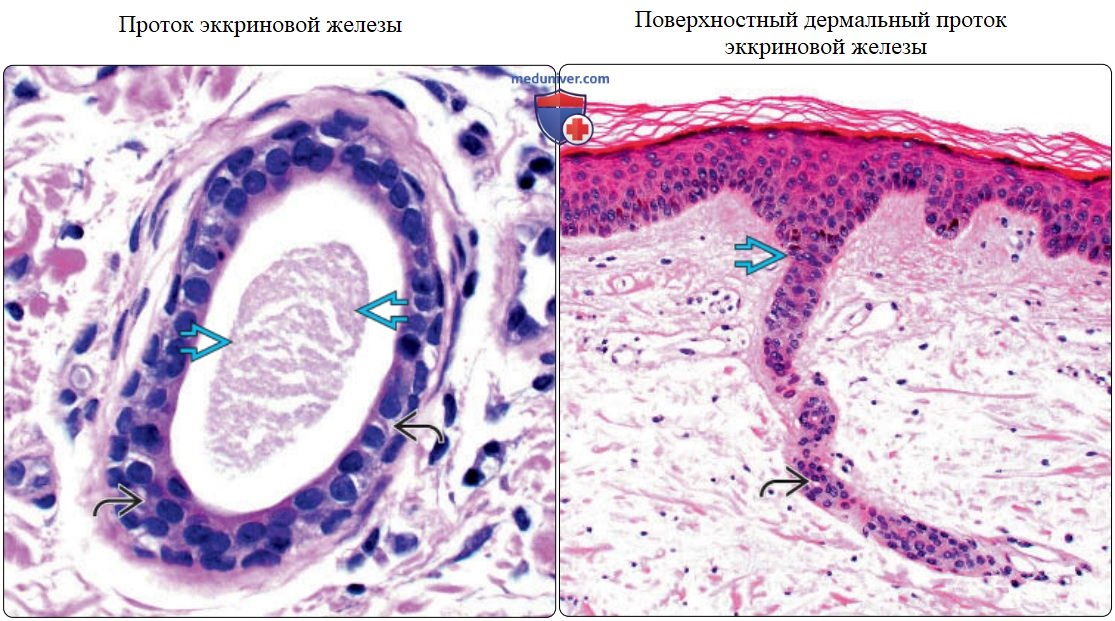Придатки кожи - нормальная гистология под микроскопом