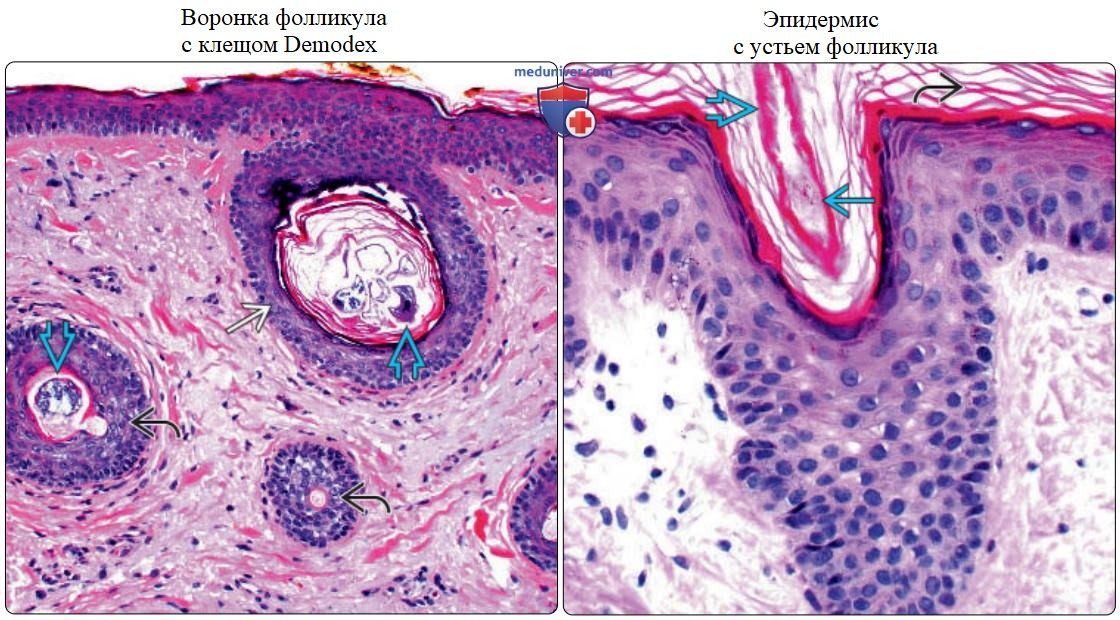 Придатки кожи - нормальная гистология под микроскопом