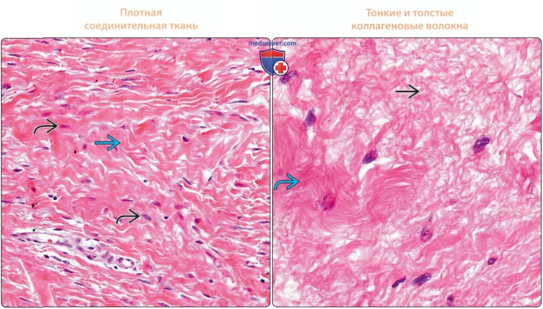 Соединительная ткань - нормальная гистология под микроскопом