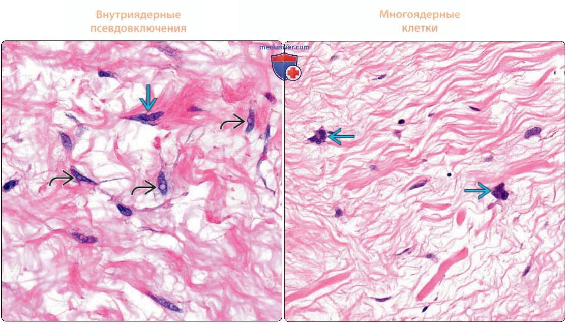 Соединительная ткань - нормальная гистология под микроскопом